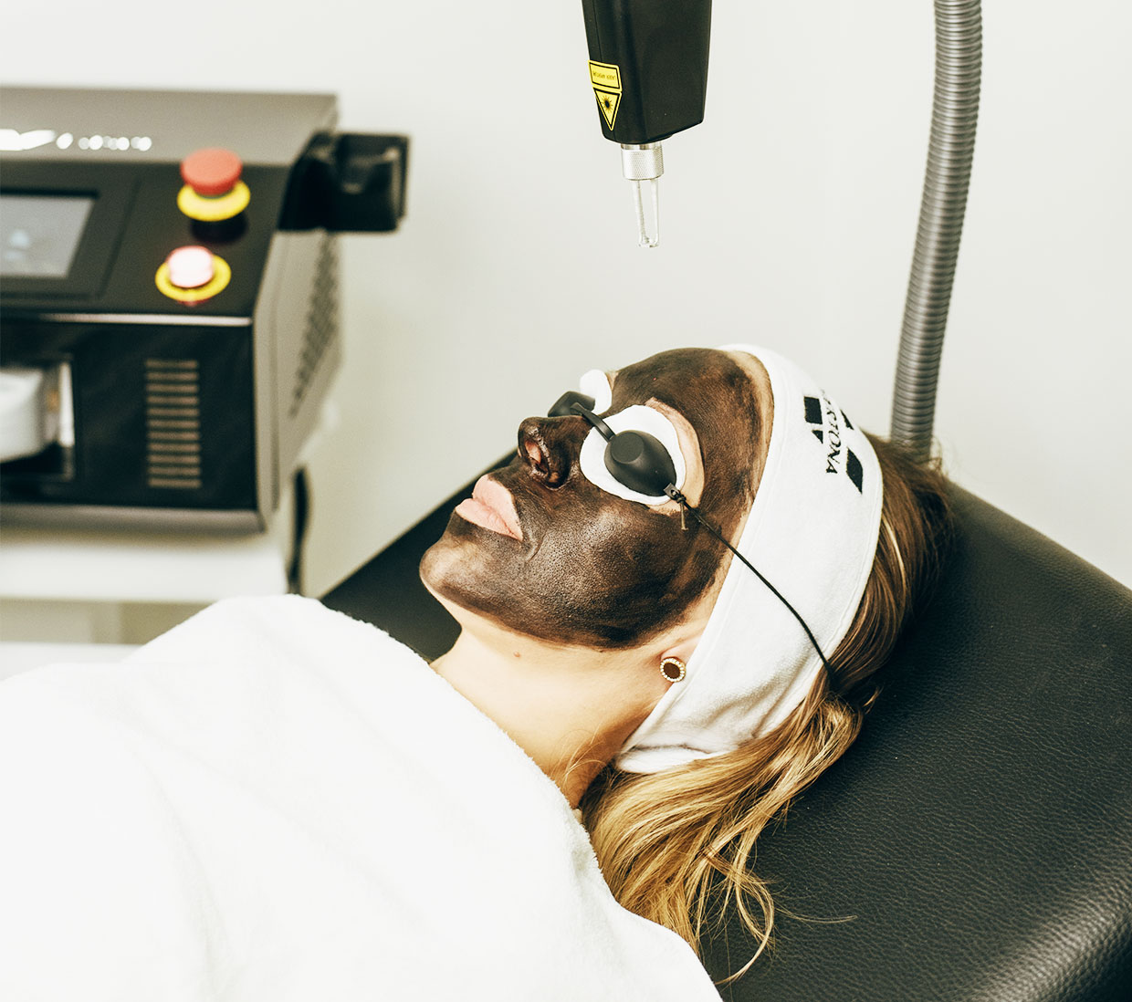 Carbon peel cream - krema za karbon laserski piling